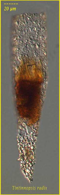 Tintinnopsis radix