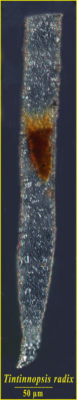 Tintinnopsis radix