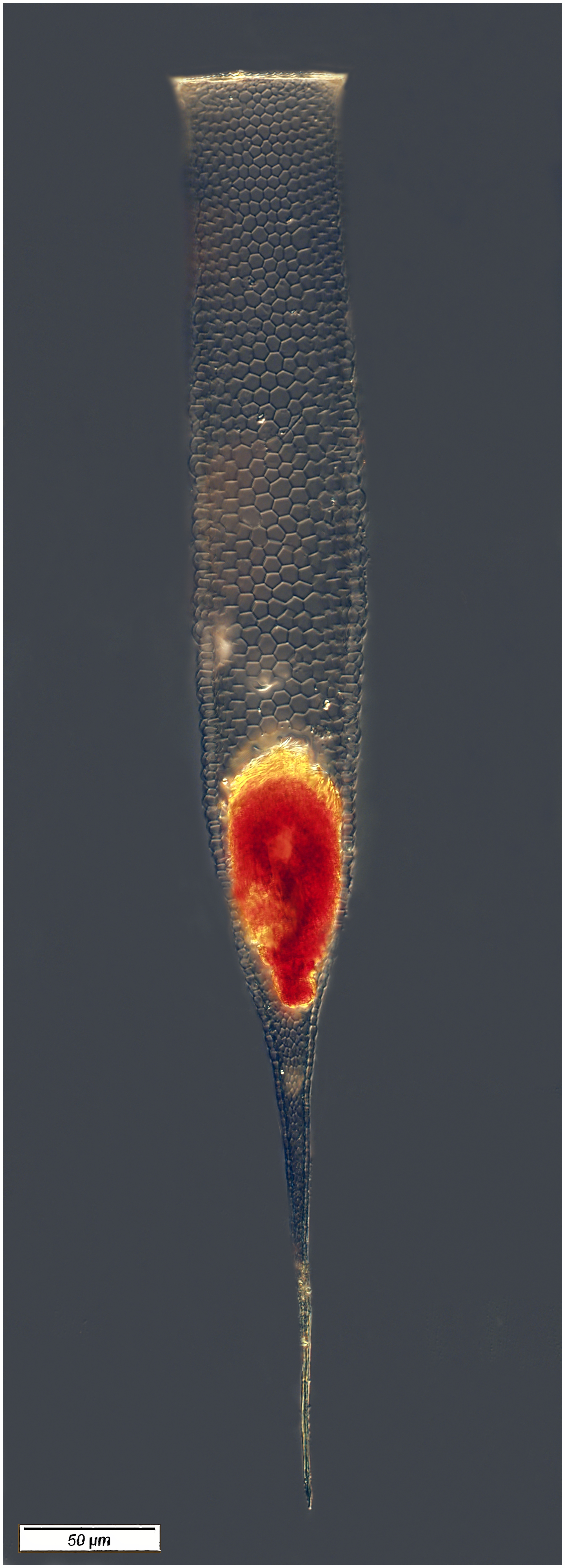 Xystonella lohmanni