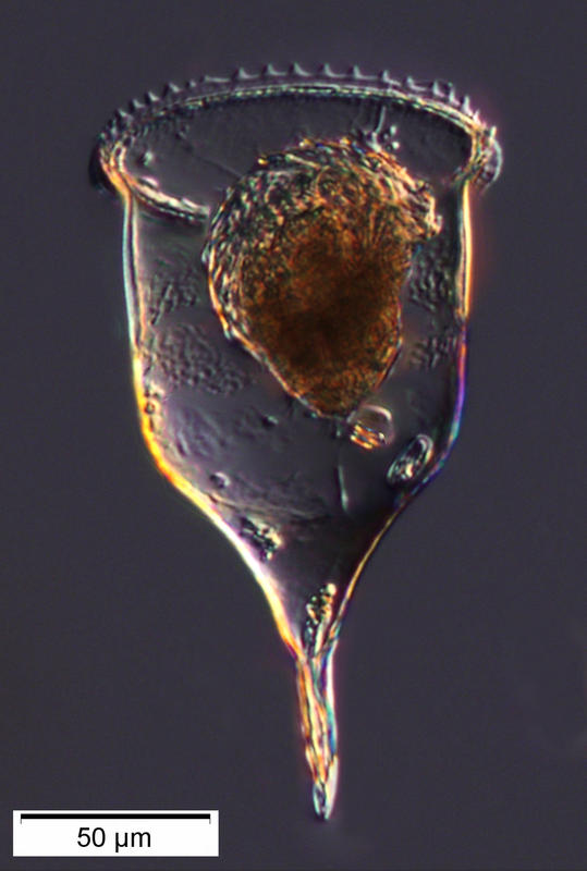 Cymatocylis brevicaudata 'morph'