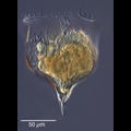 Cymatocylis diminuta 'morph'
