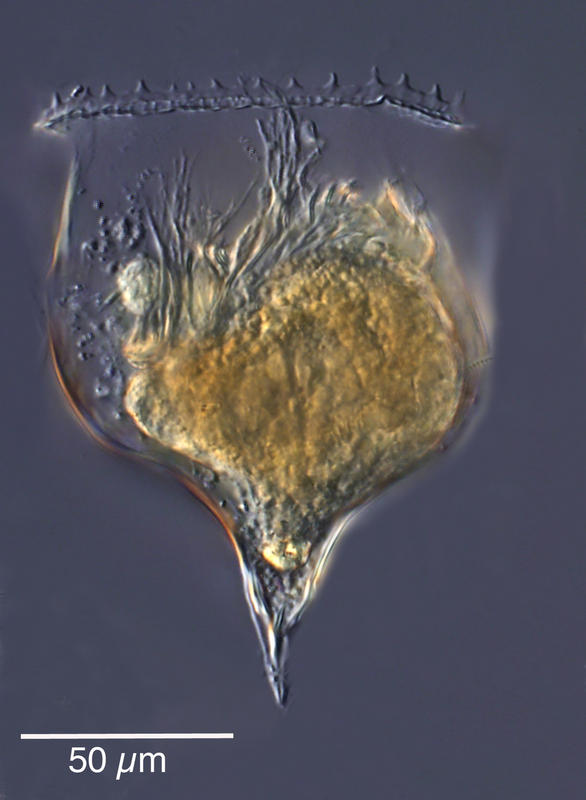 Cymatocylis diminuta 'morph'