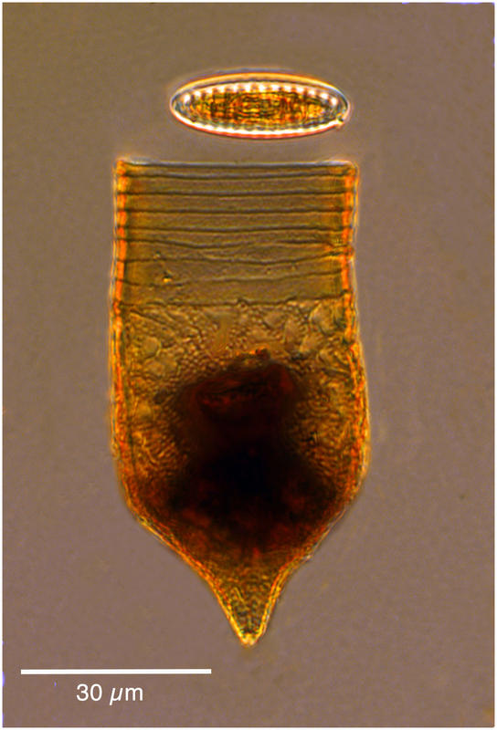 Codonellopsis glacialis