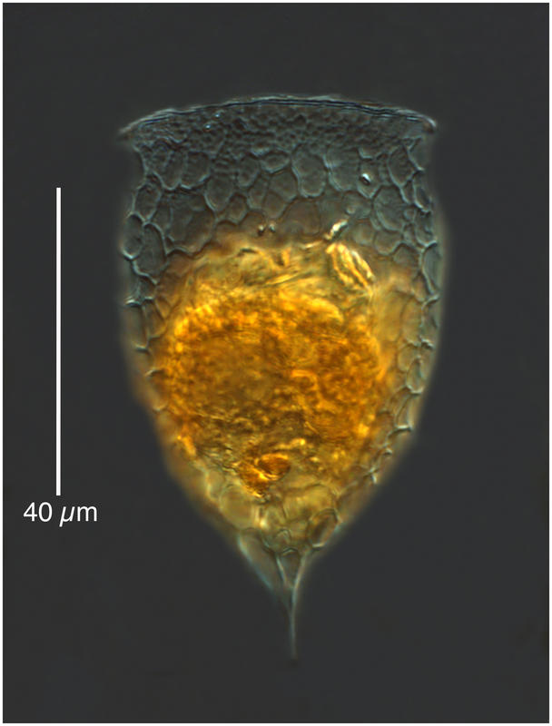 Epiplocylis freymadli