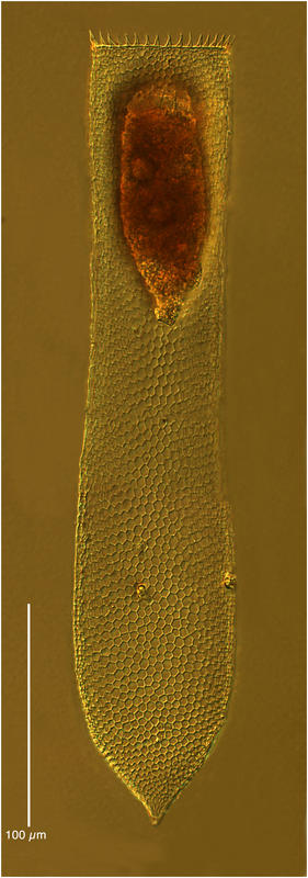 Parafavella ventricosa (Jörgensen 1900)