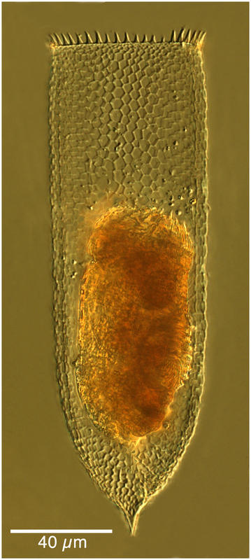 Parafavella subrotundata