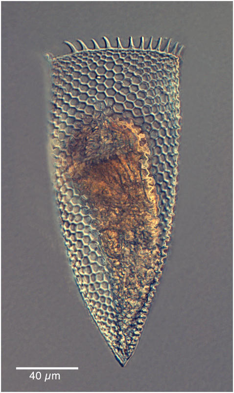 Parafavella parumdentata morphotype