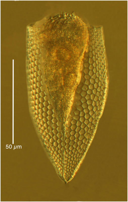 Parafavella edentata