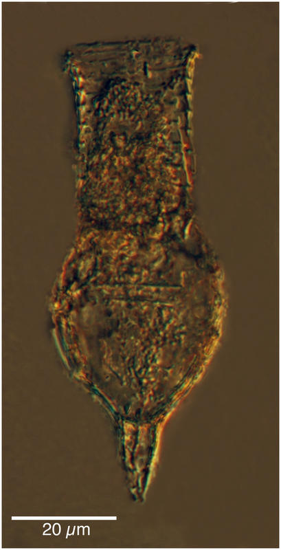 Codonellopsis borealis Hada 1937