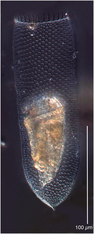 Parafavella rotundata