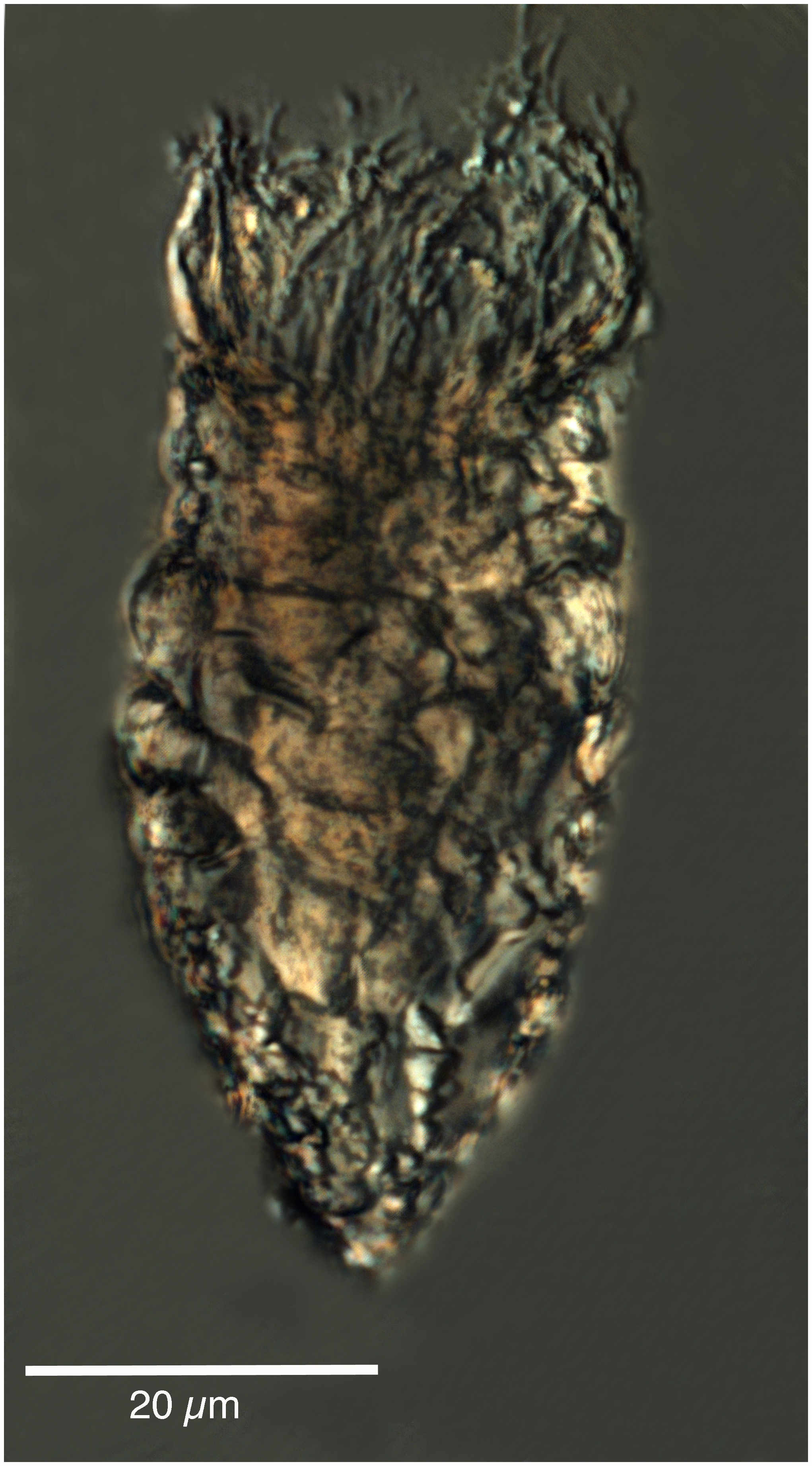 Tintinnopsis rapa
