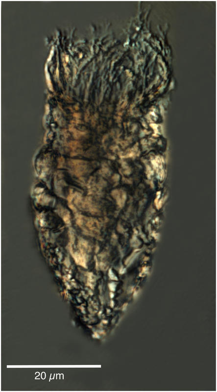 Tintinnopsis rapa