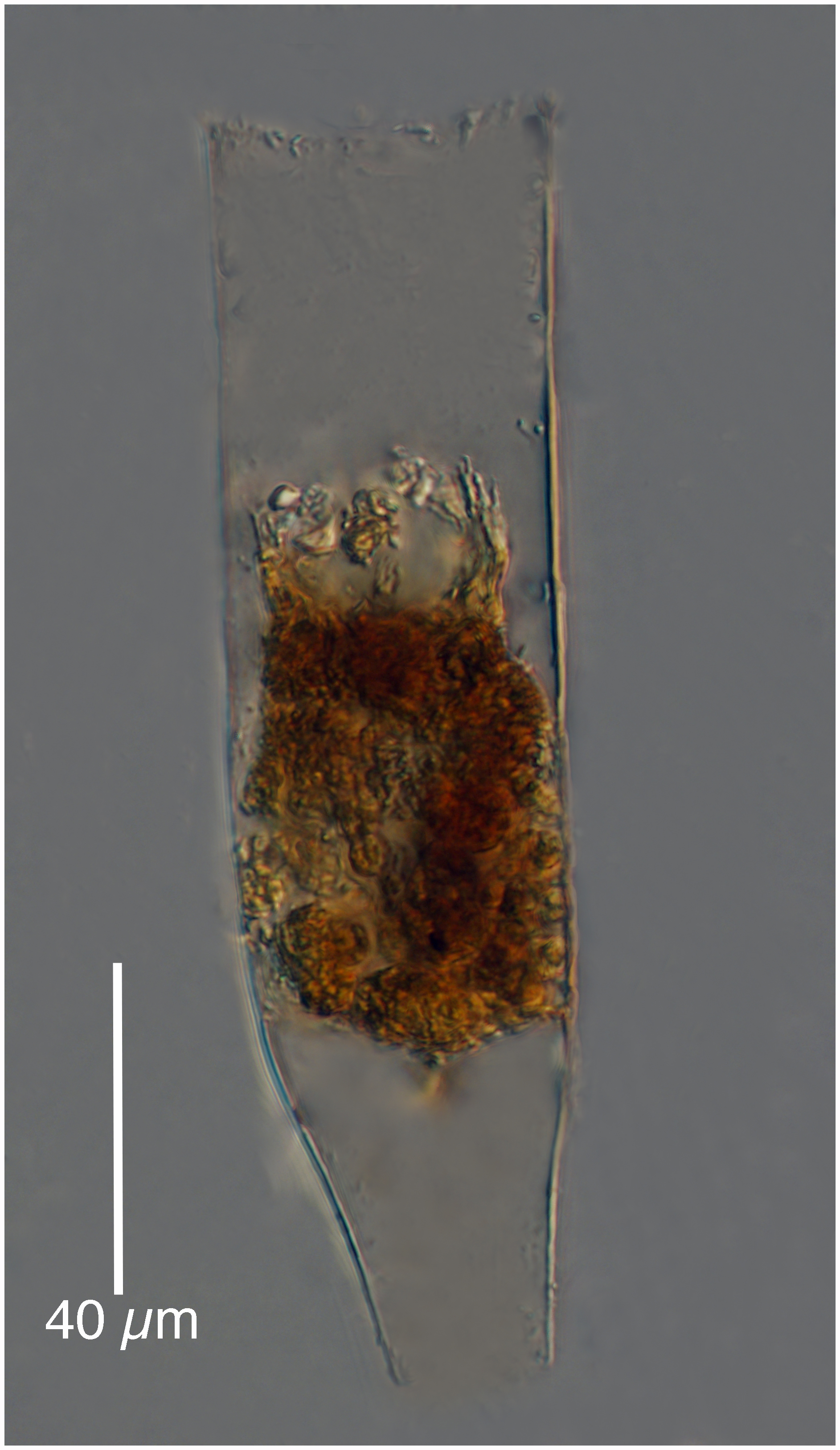 Eutintinnus apertus (Kofoid & Campbel 1929)