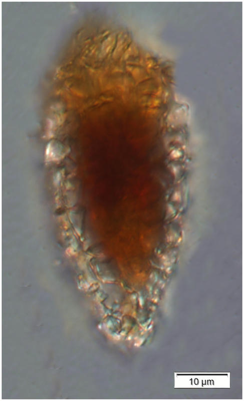 Tintinnopsis rapa