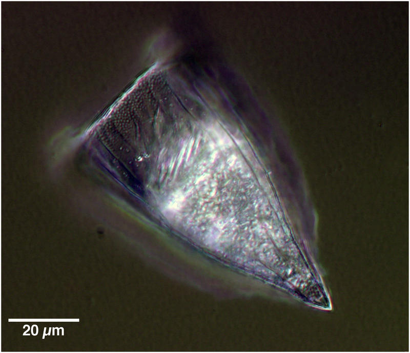 Rhabdonella amor