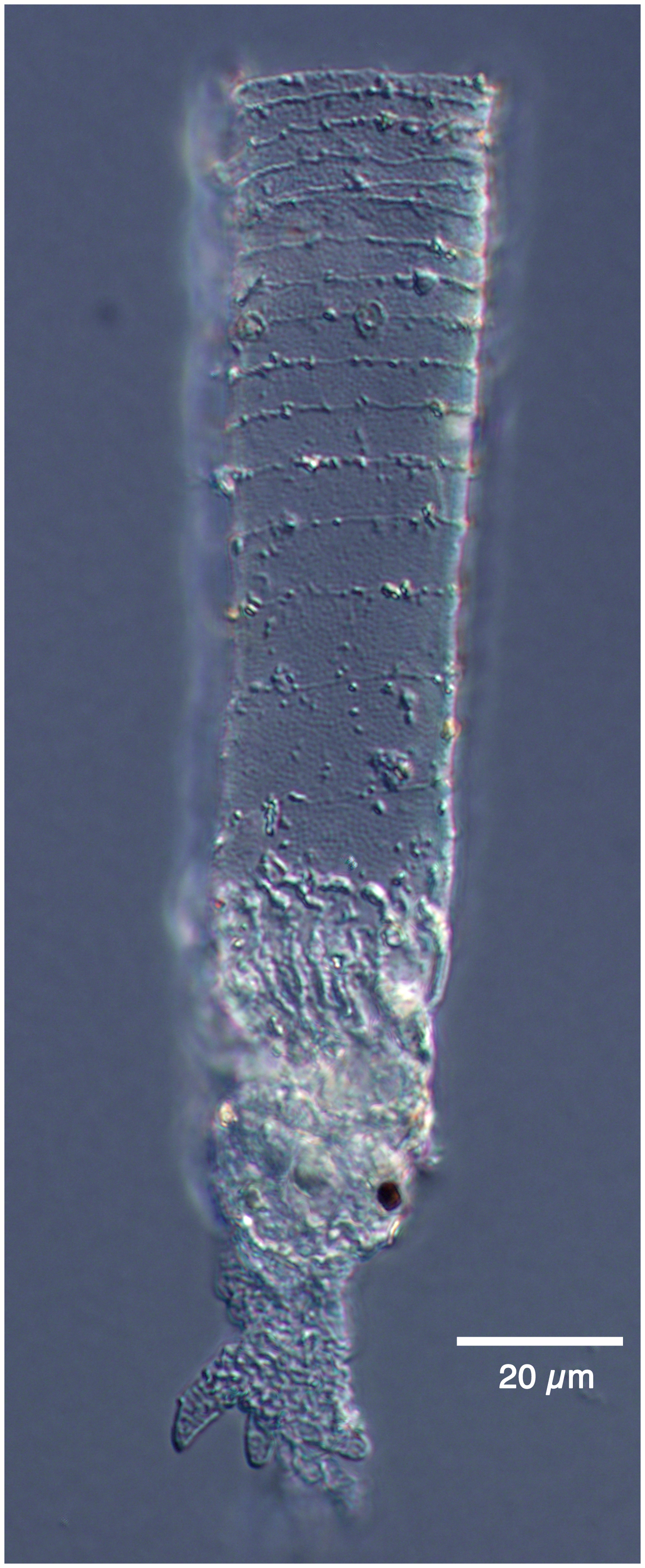 Rhizodomus tagatzi from an Adriatic Lagoon.