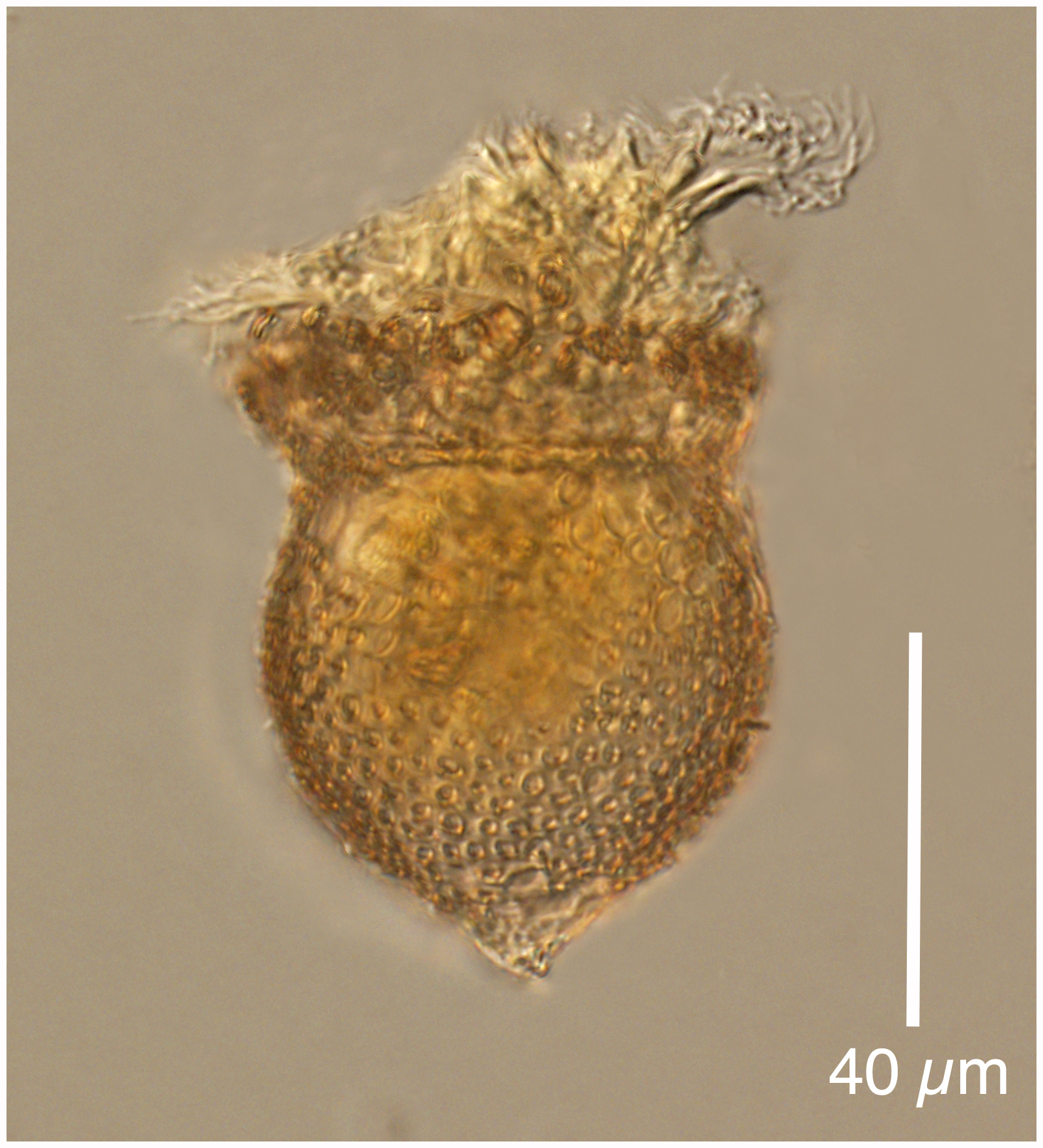 Codonella perforata