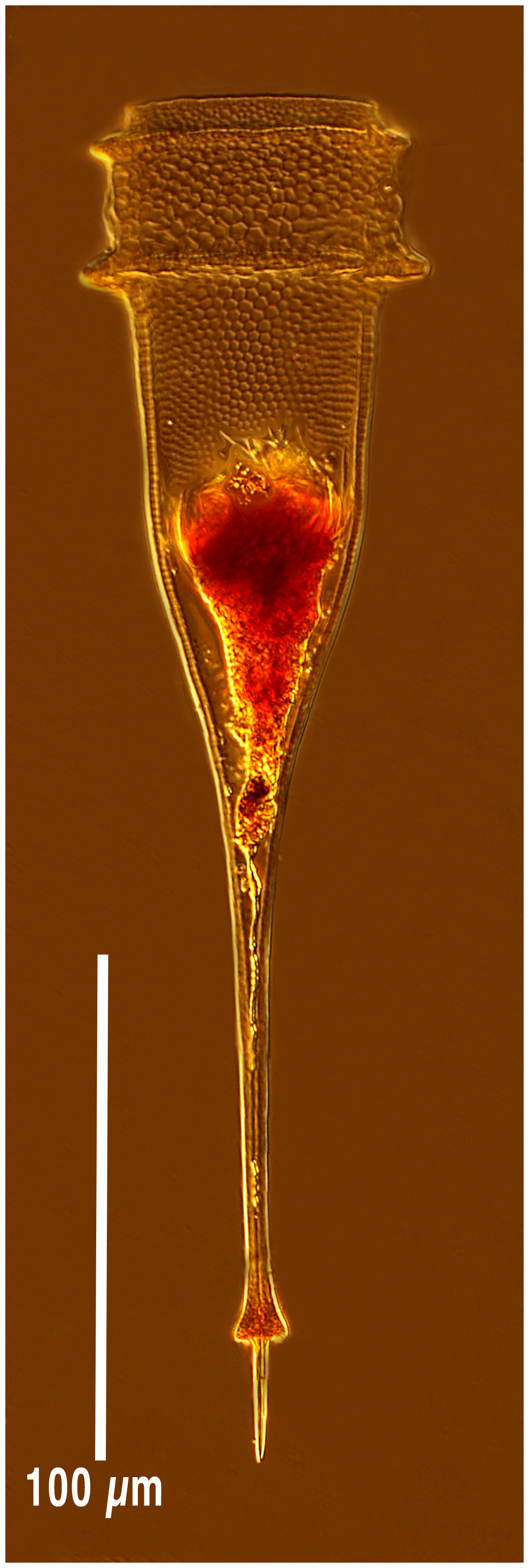 Xystonellopsis dicymatica