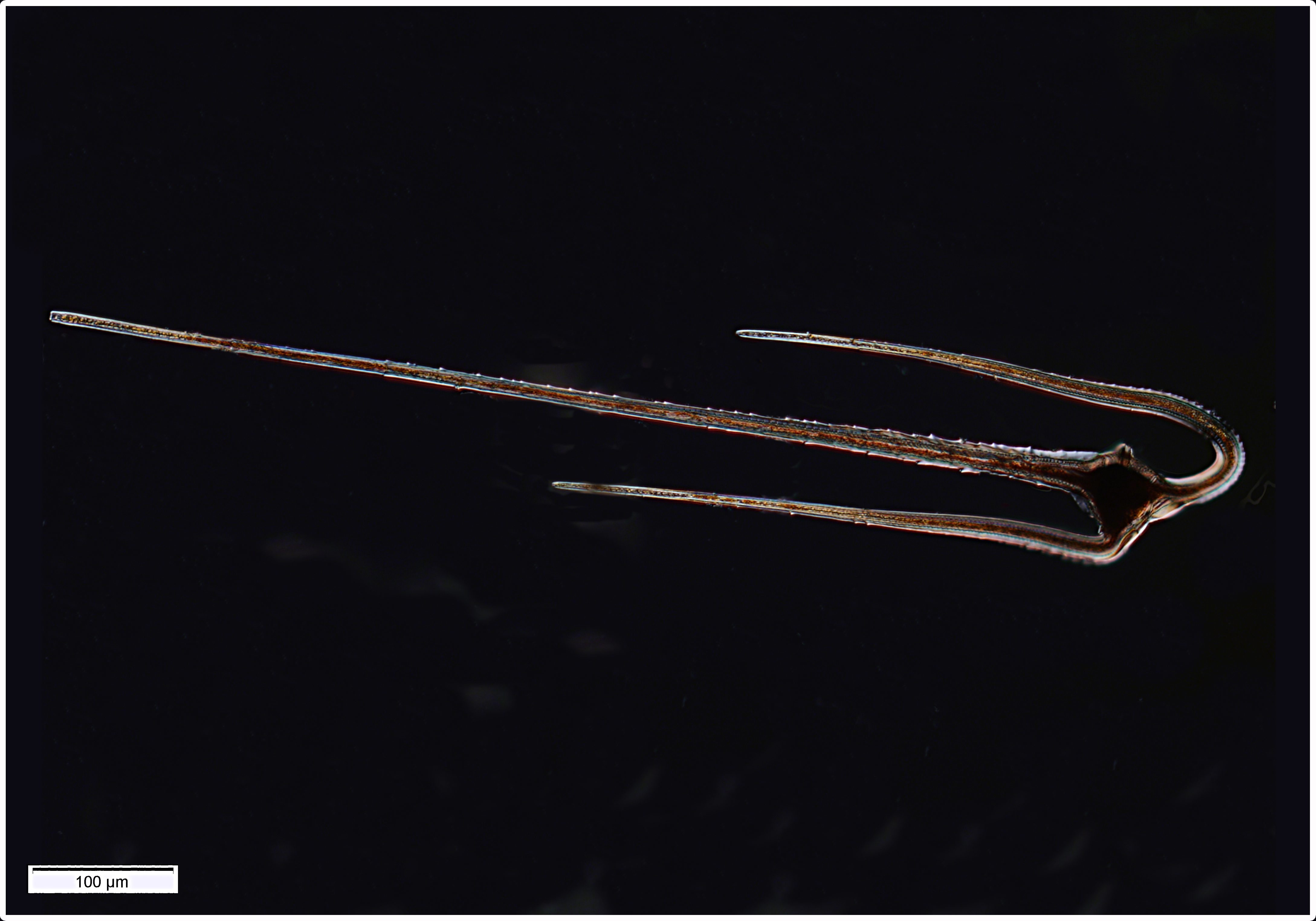 Ceratium vultur