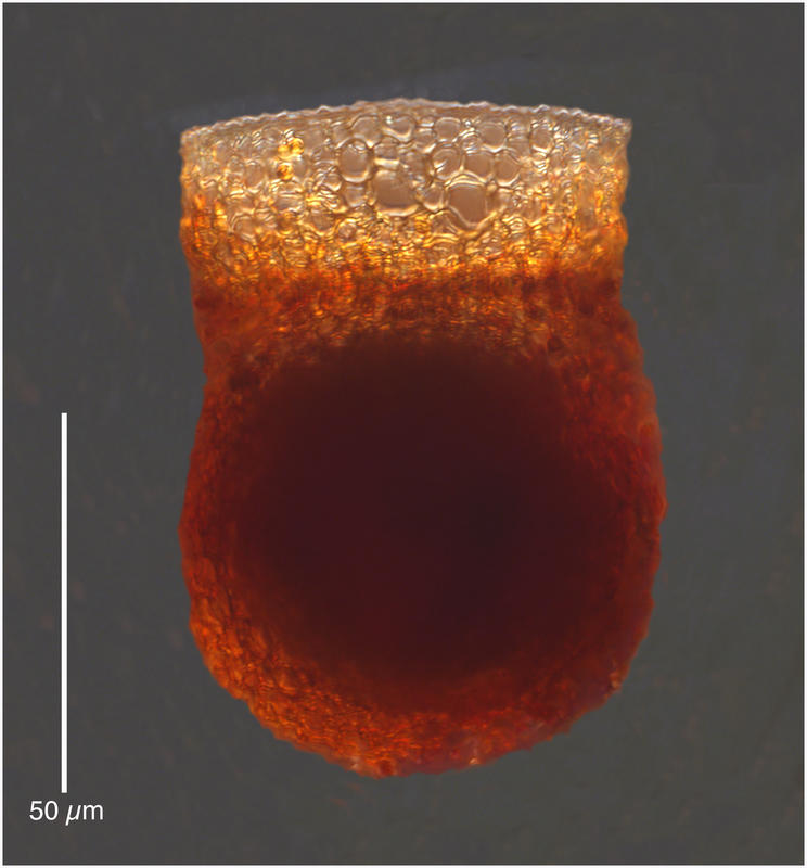 Codonella robusta
