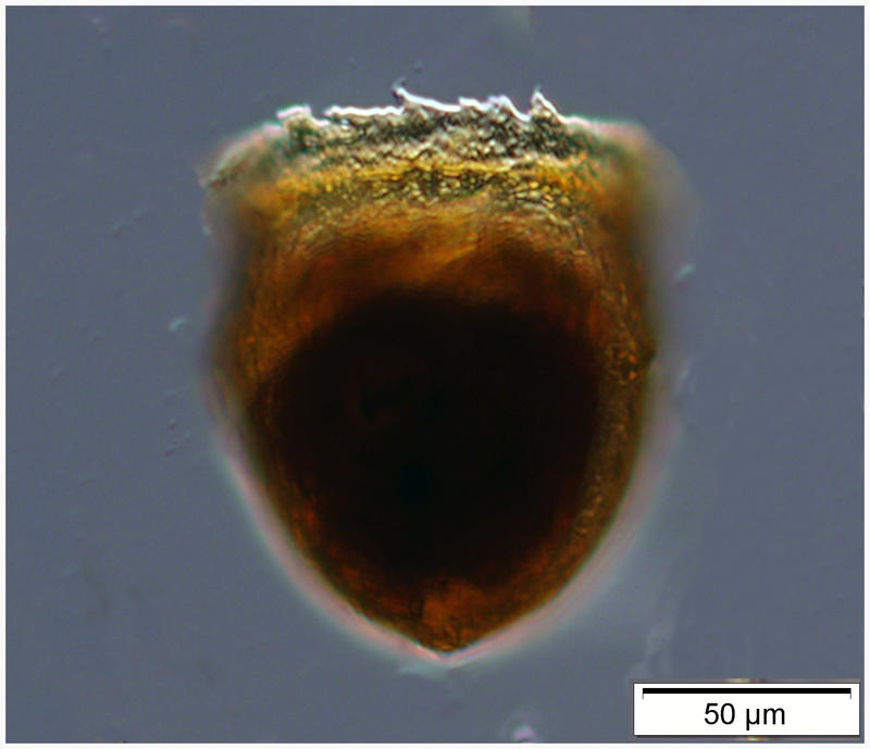 odd ampulla