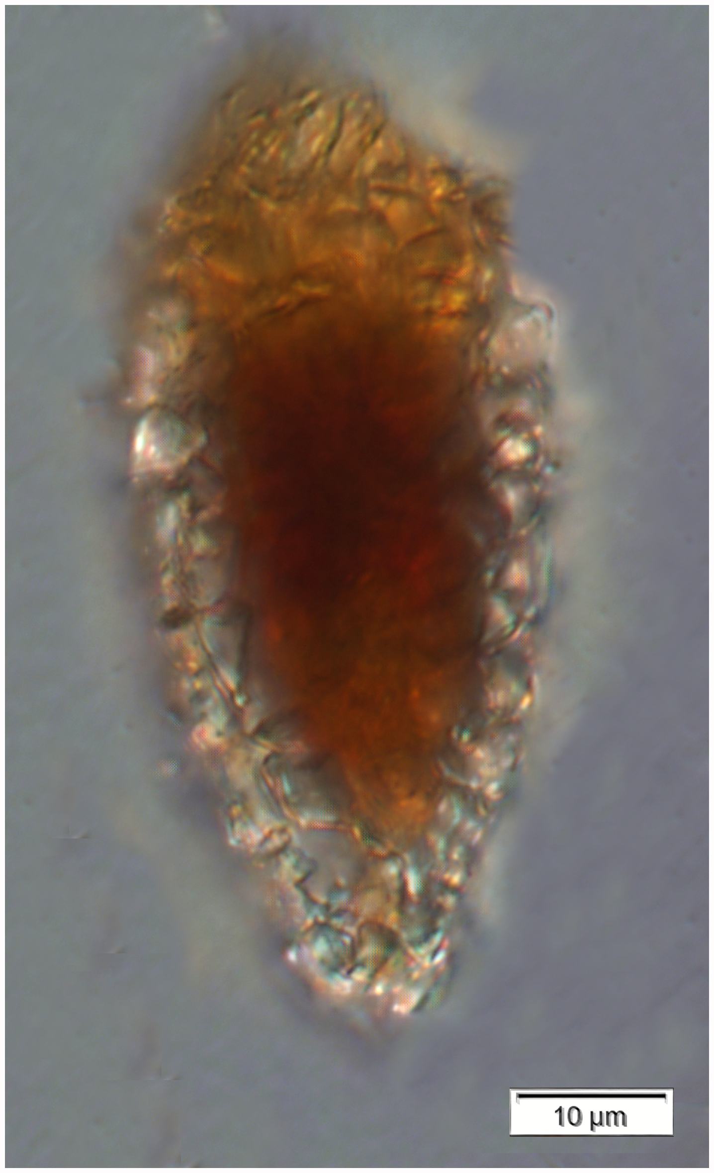 Tintinnopsis rapa