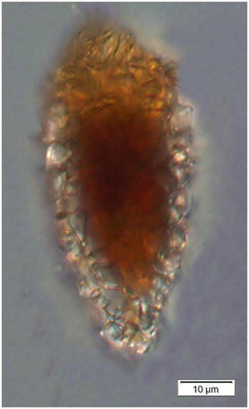 Tintinnopsis rapa