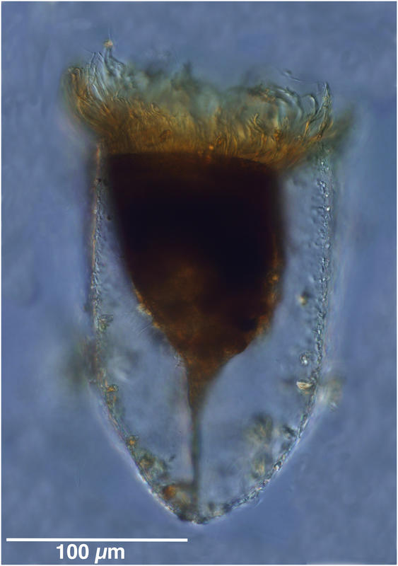 Bursaopsis vitrea