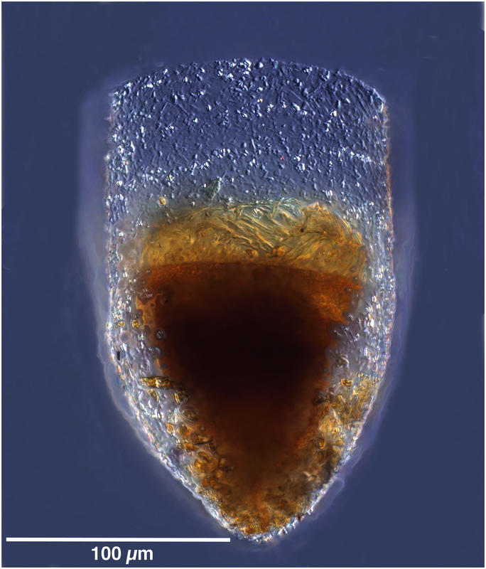 Bursaopsis vitrea