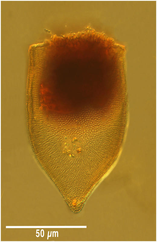 Favella azorica from Point B (Bay of Villefranche) July 13 2015