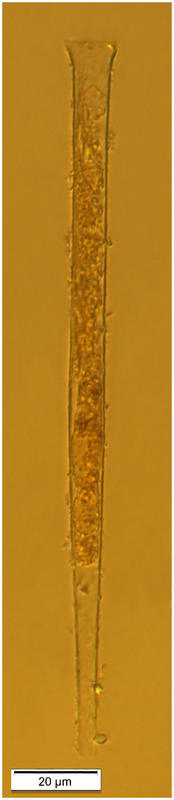 Salpingella species (new?)