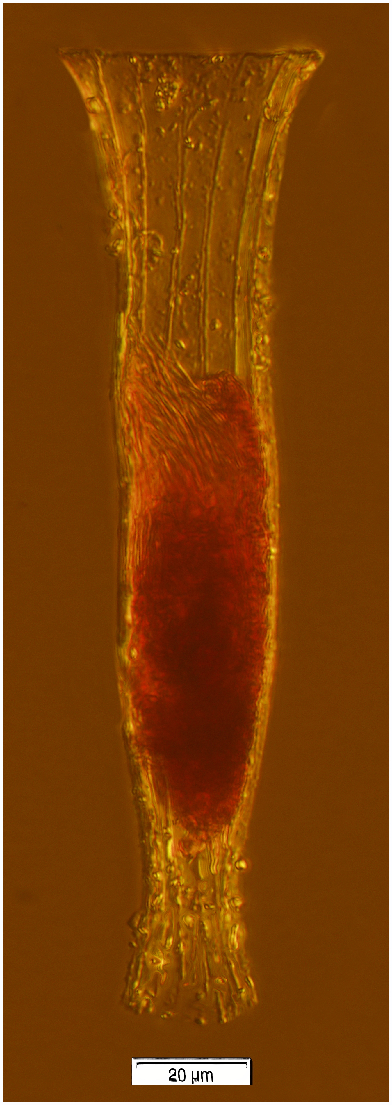 Daturella striata (Kofoid & Campbell 1929)