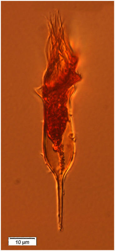 Albatrossiella agassizi
