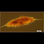 Deep Sea Ciliate