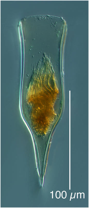 Parundella lohmanni (Jorgensen 1924)