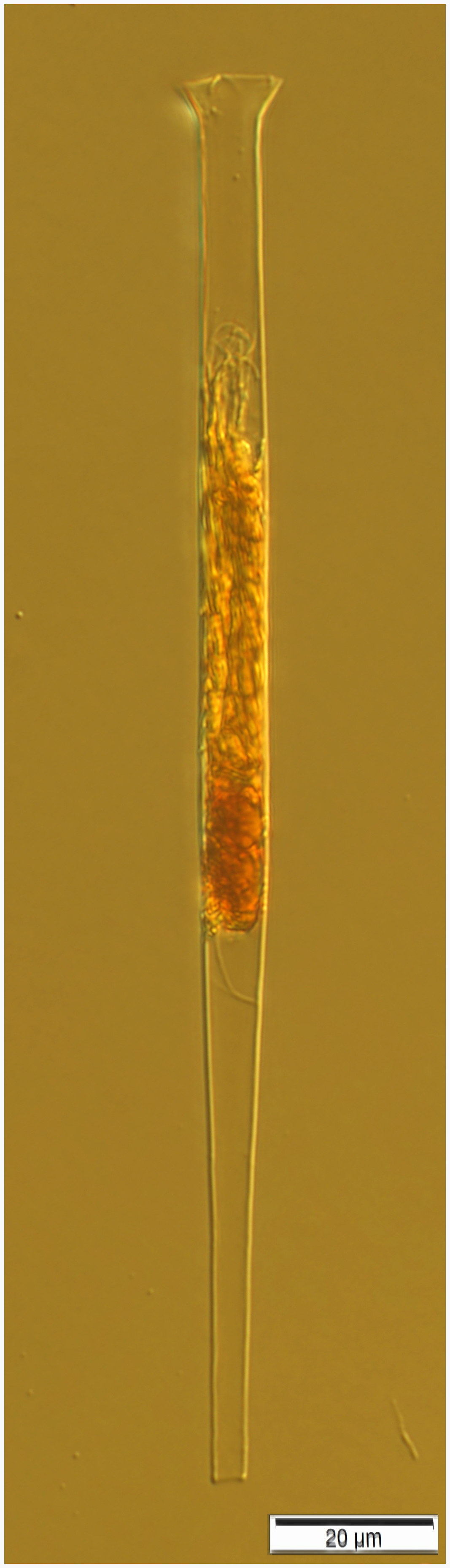 Salpingella "thin species" apparently undescribed.