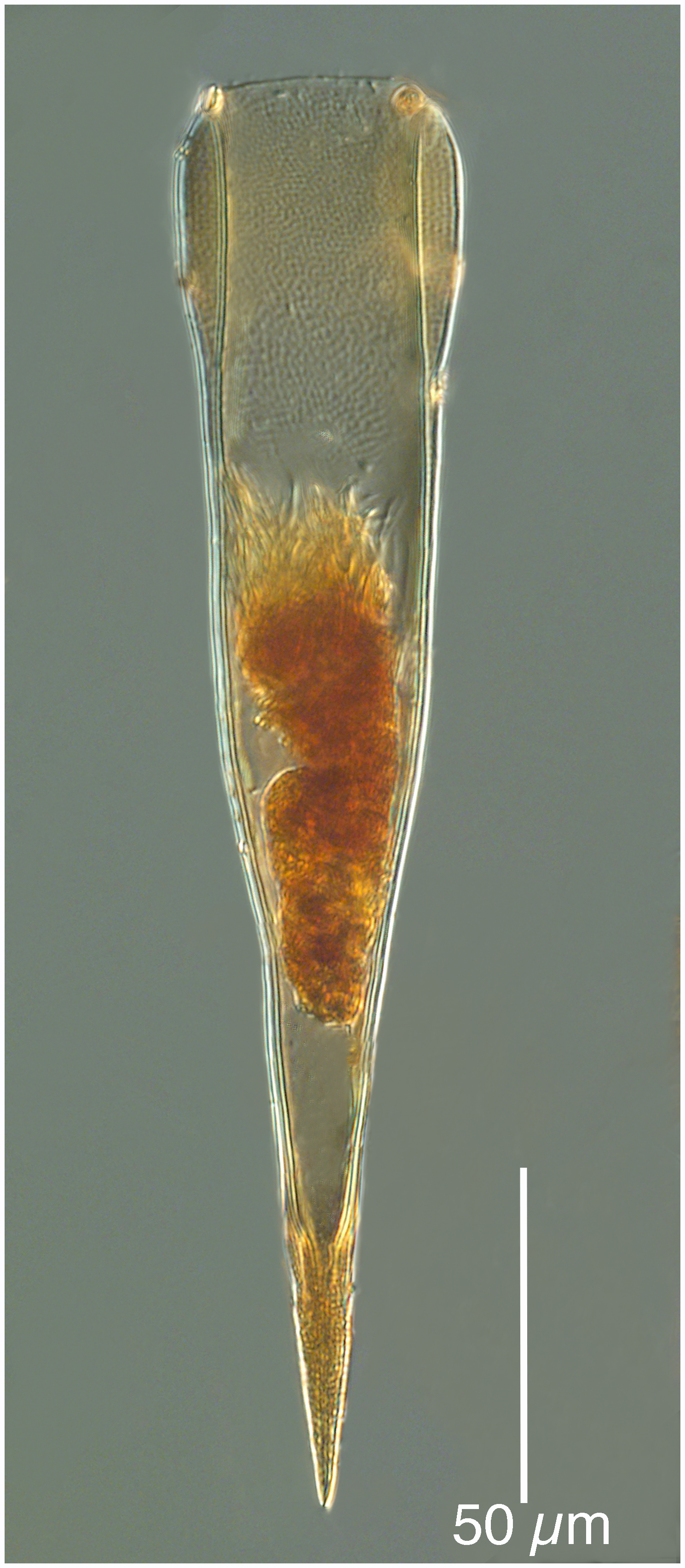 Xystonellopsis brandti