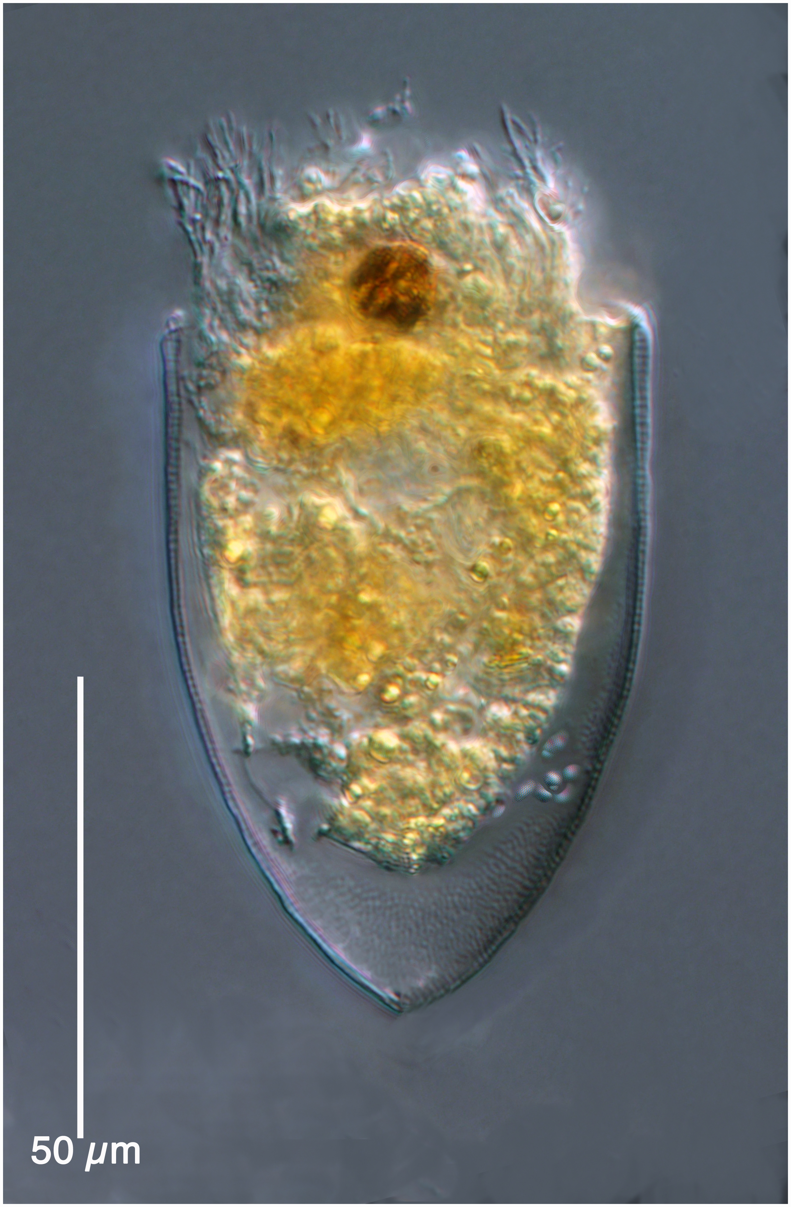 Favella sp.