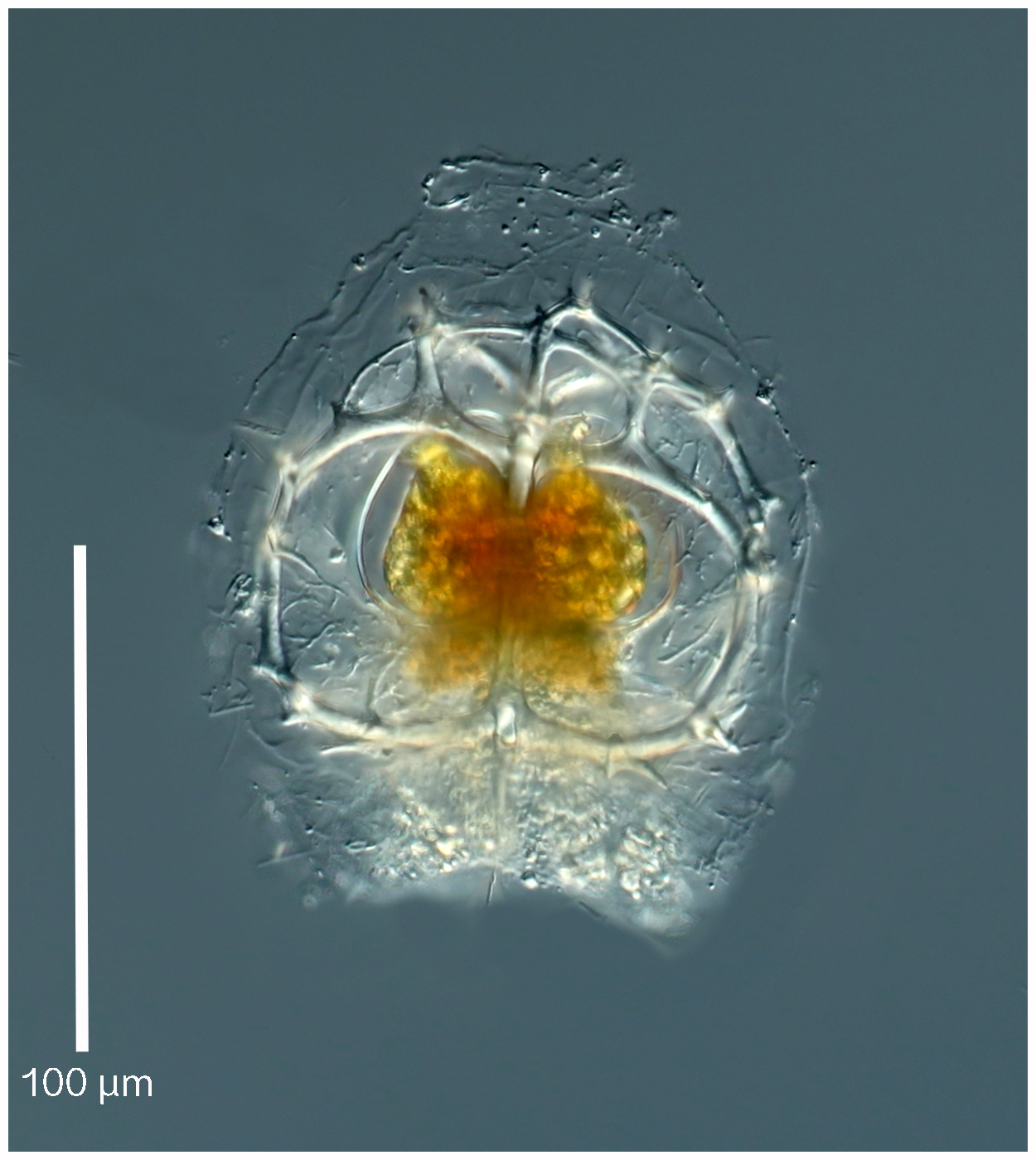Ceratospyris borealis Bailey 1856