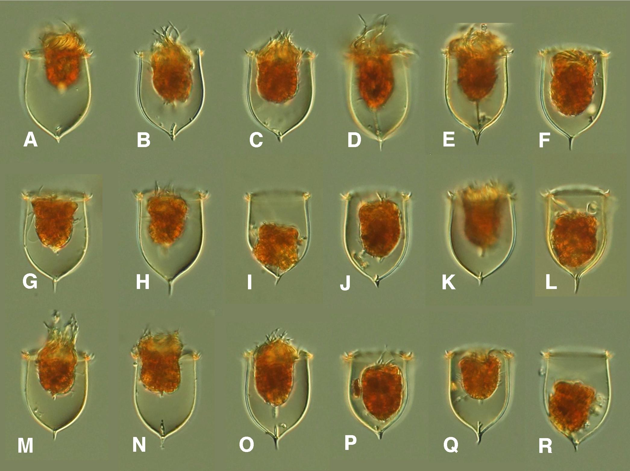 Acanthostomell norvegica from a single sample (Chukchi Sea 2017, Station 34)