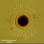 Ciliate Cyst 'wagon wheel'