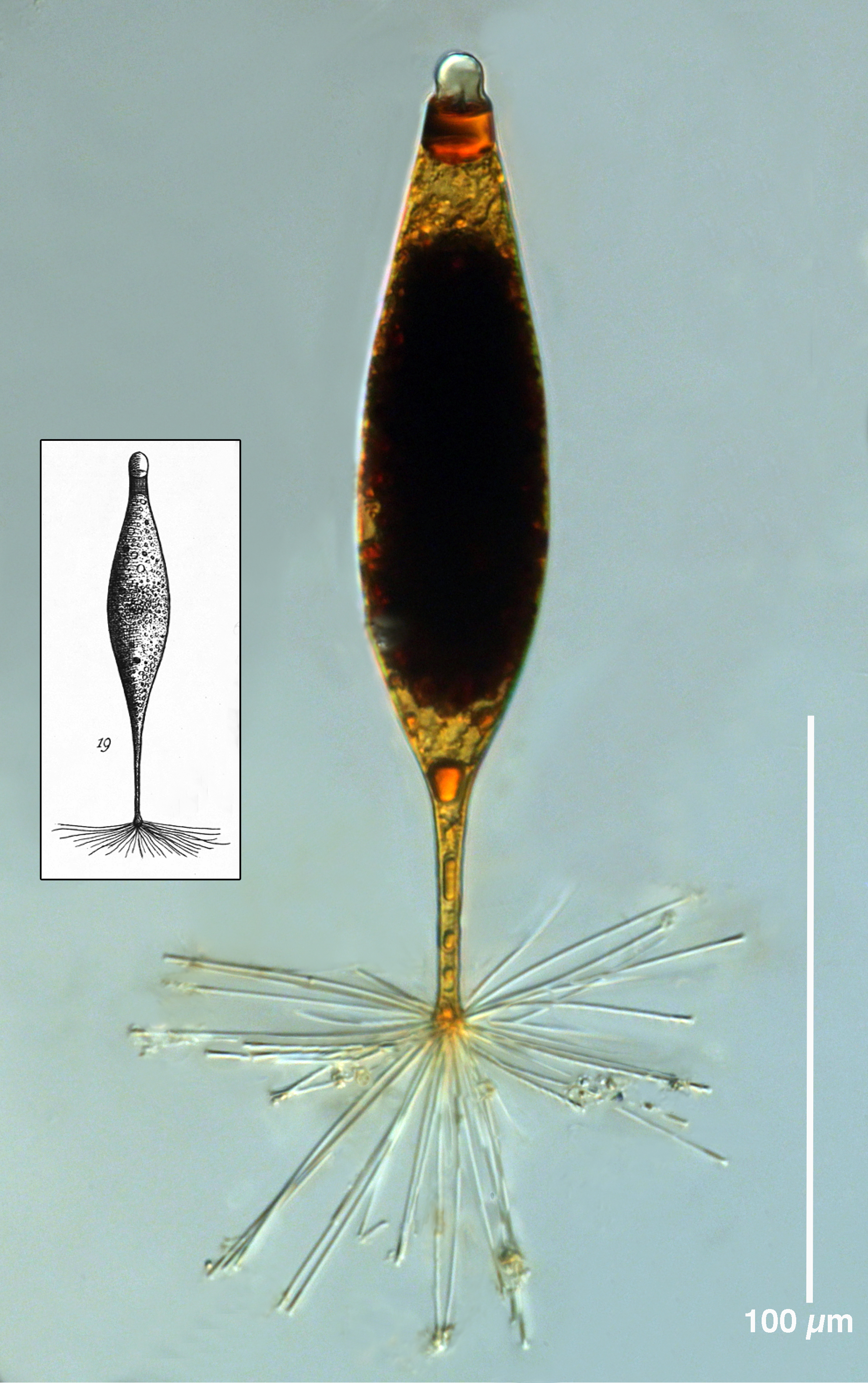 Presumptive Ciliate Cyst 'Fusopsis umbracula'