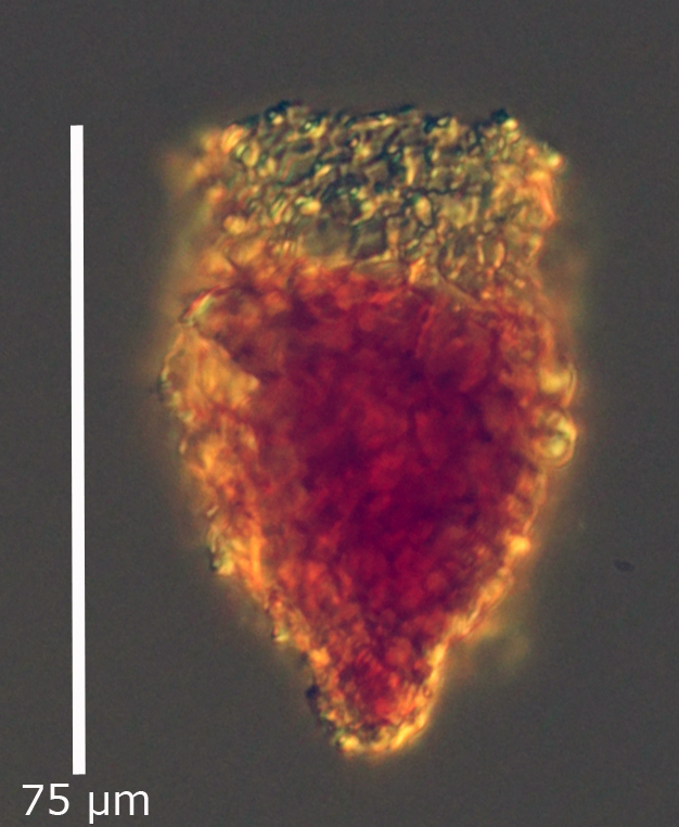 Tintinnopsis chinglanensis