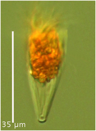 Tiny Salpingella species!