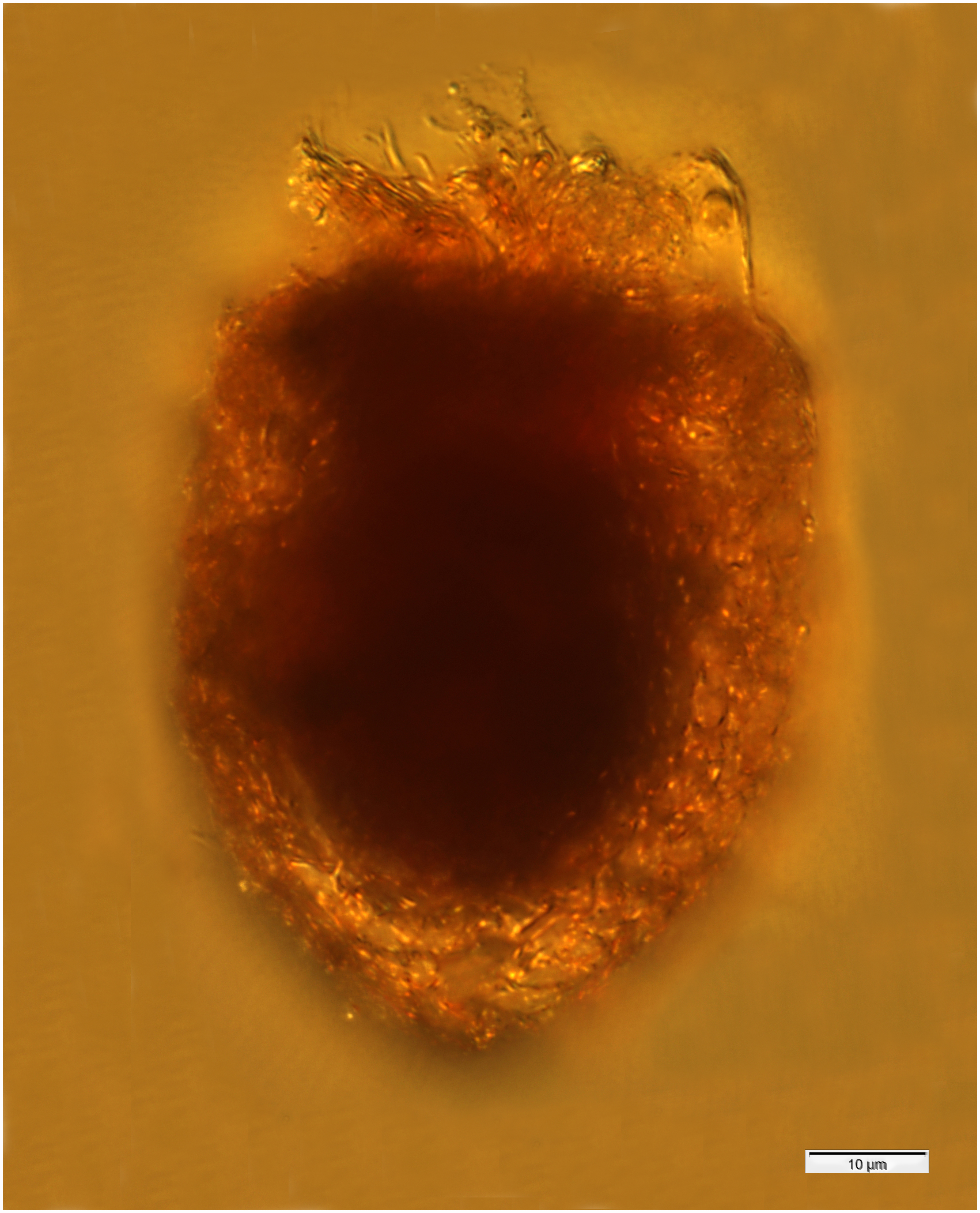 Tintinnopsis lata from the Chukchi Sea