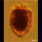 Tintinnopsis lata from the Chukchi Sea