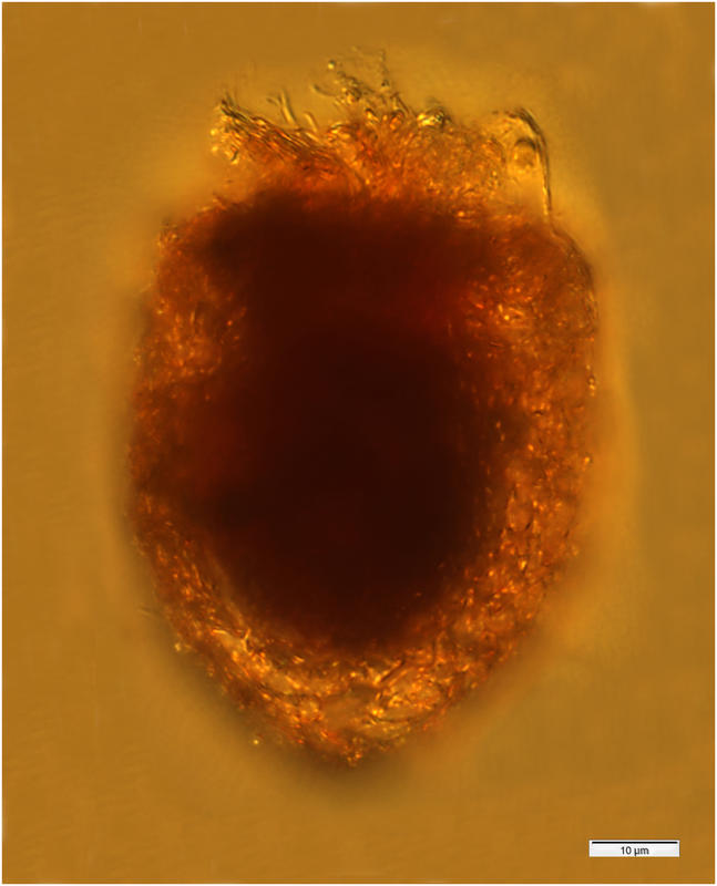 Tintinnopsis lata from the Chukchi Sea