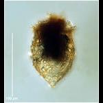 Tintinnopsis meunieri