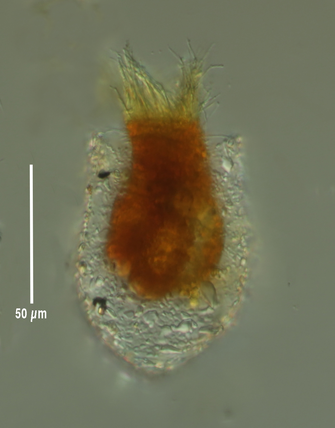 Tintinnopsis saculus