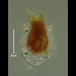 Tintinnopsis saculus